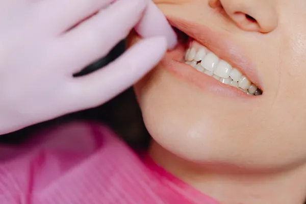 治療期間の延長